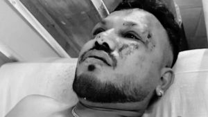 ভারতে ভয়াবহ বিমান দুর্ঘটনার পর বেঁচে যাওয়া একমাত্র যাত্রী বিশ্বাস কুমার রমেশ।